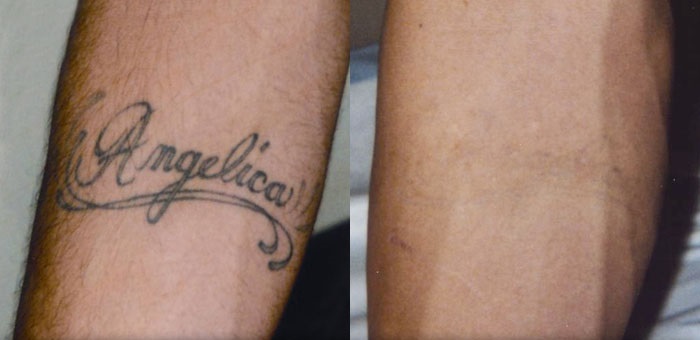 tatts-on-tatts-off-gungahlin-2911-thumbnail